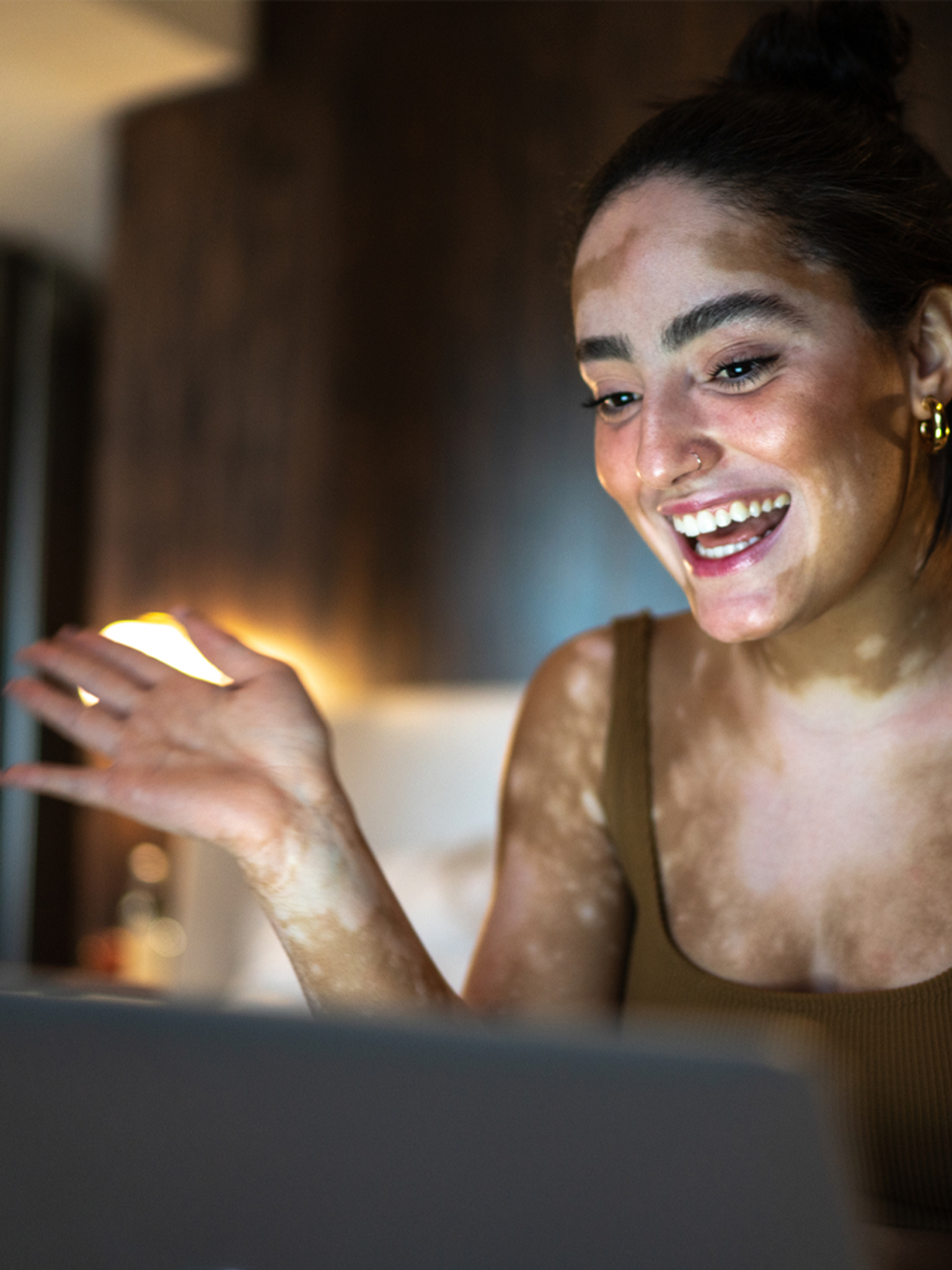 A woman with vitiligo smiles joyfully at her laptop screen in a warmly lit room.